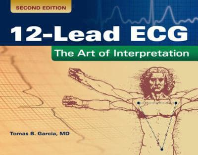 12-Lead ECG: The Art of Interpretation